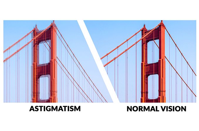 Understanding Astigmatism and Its Solutions